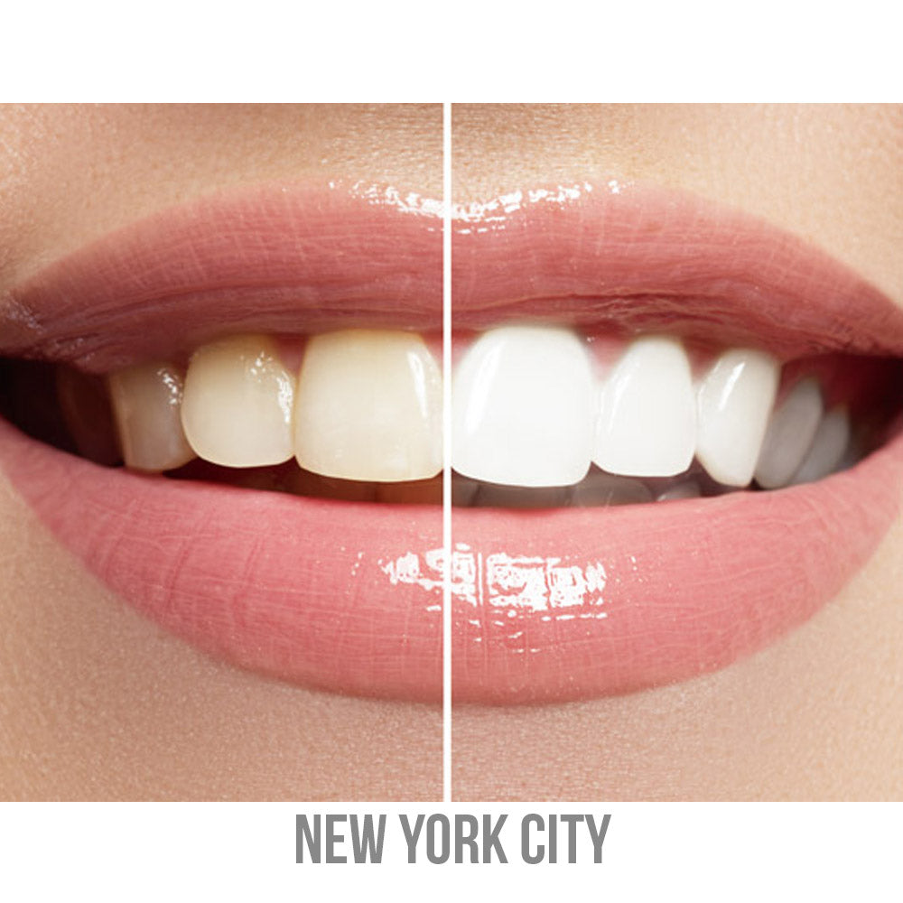 In-Office Teeth Whitening Buy 2 get 1 FREE