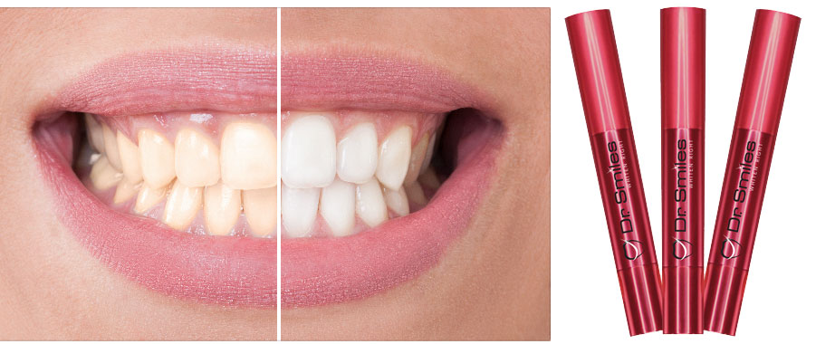 How to Get the Best Results from a Teeth Whitening Pen